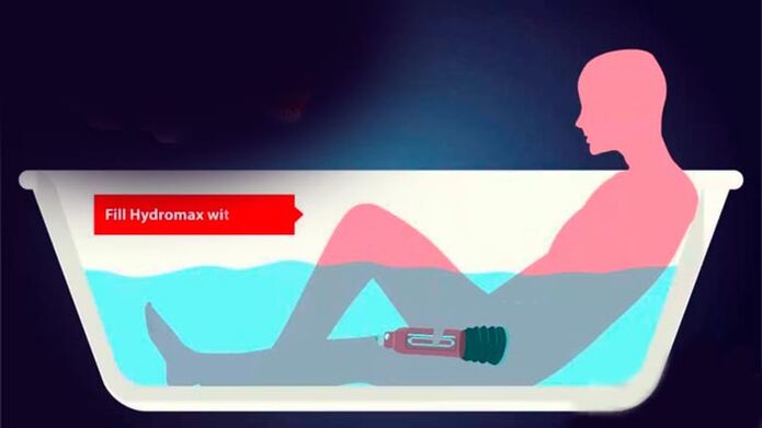 Augmente un membre d'une pompe à eau
